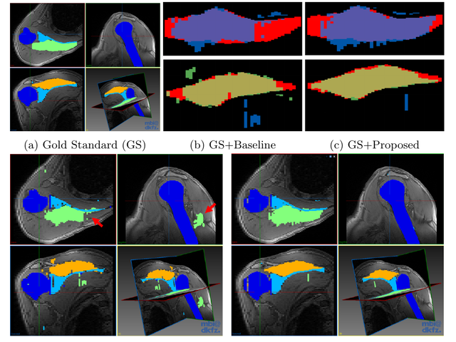 Ground-truth, baseline, and proposed active-learning segmentation examples.