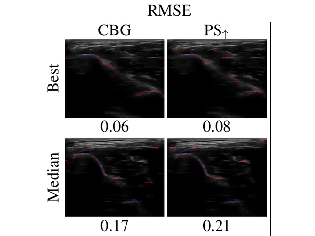 Best and median ultrasound cases comparing constrained bone graphs with phase symmetry.