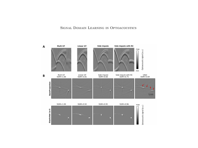 Signal- and image-domain comparisons for limited-view optoacoustic reconstruction.