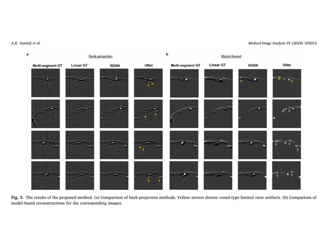 Grid comparing optoacoustic reconstructions from baseline and SDAN methods.