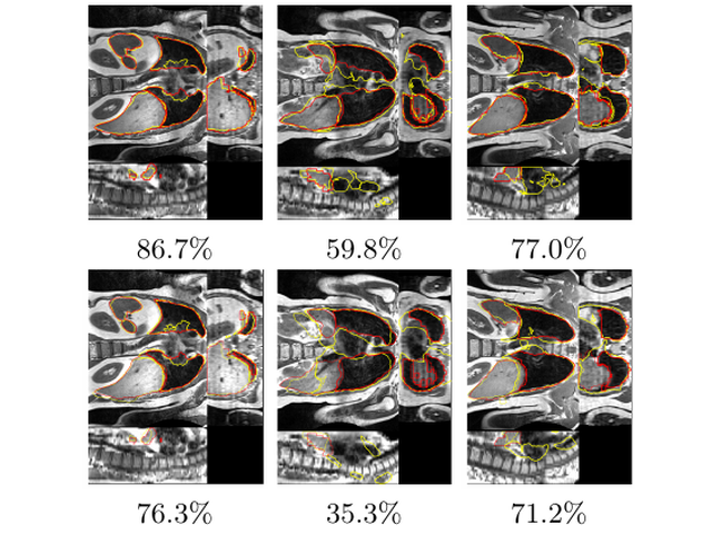 Thoracic CT and MRI registration examples with anatomical contour overlays.